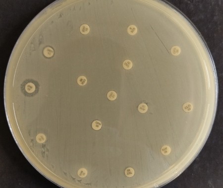 Risco global: bactéria multirresistente é encontrada em paciente brasileira