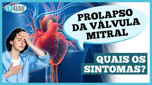 Dr. Ajuda: o que é o prolapso mitral?