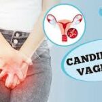 Candidíase Vaginal: o que é, sintomas, diagnóstico, tratamento e prevenção