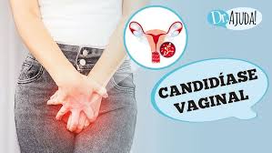 Candidíase Vaginal: o que é, sintomas, diagnóstico, tratamento e prevenção