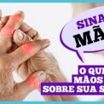 Dr. Ajuda: O que suas mãos podem dizer sobre sua saúde