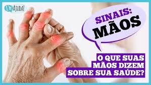 Dr. Ajuda: O que suas mãos podem dizer sobre sua saúde