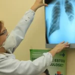 Ministério da Saúde repassa R$ 100 milhões para combate à tuberculose em 913 municípios