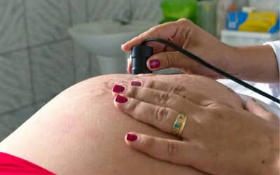 Brasil permanece entre os três países que mais realizam cesarianas no mundo (2023)
